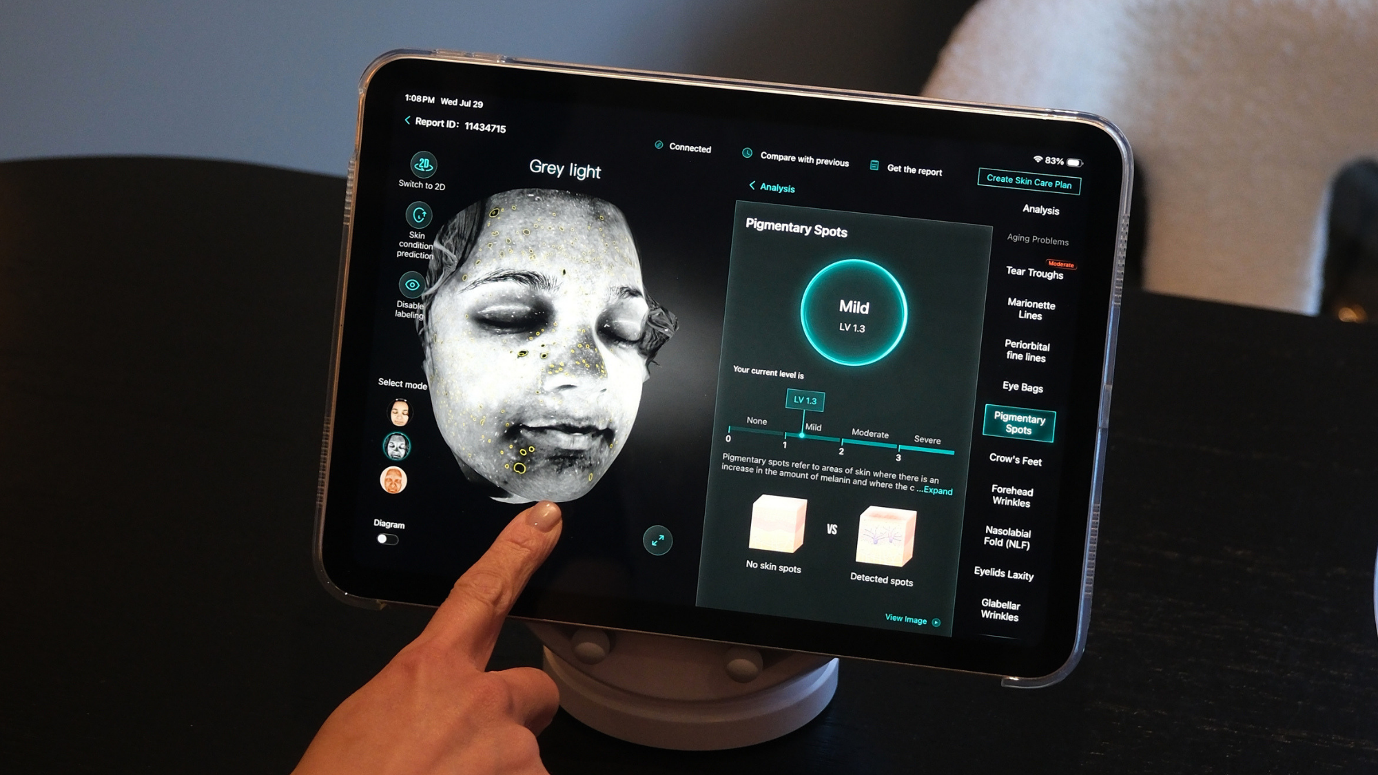 How a Skin Analysis Appointment Can Teach You More About Your Skin